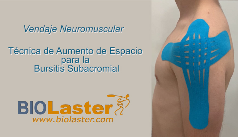 Vídeo: Técnica de Aplicación de Vendaje Neuromuscular