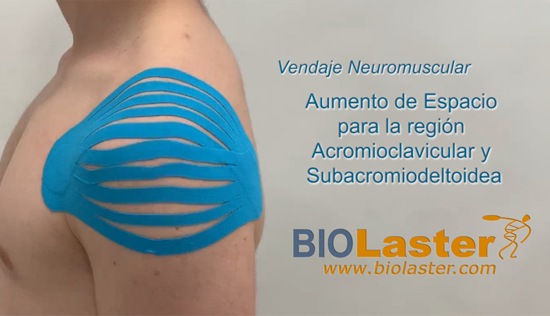 Técnica de Kinesiotaping en la región Acromioclavicular en vídeo