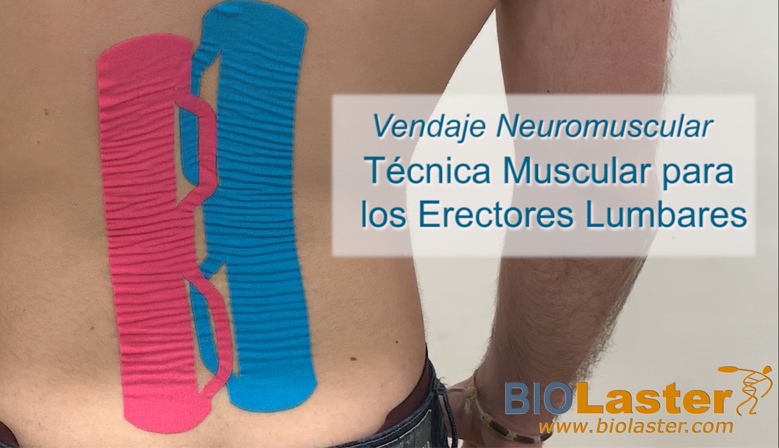 Vdeo: Actualizacin de Tcnica de Vendaje Neuromuscular para la Zona Lumbar