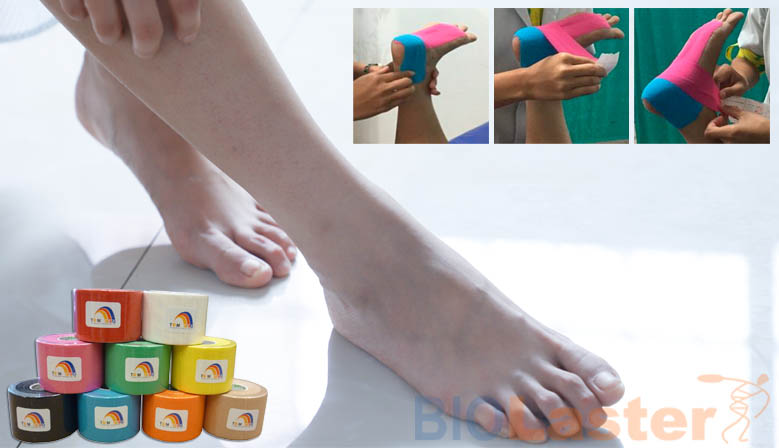 Tratamiento de los pies planos con Kinesiotaping