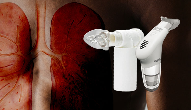 Eficacia del Entrenamiento de la Musculatura Respiratoria en personas con Bronquiectasia: Revisión Sistemática