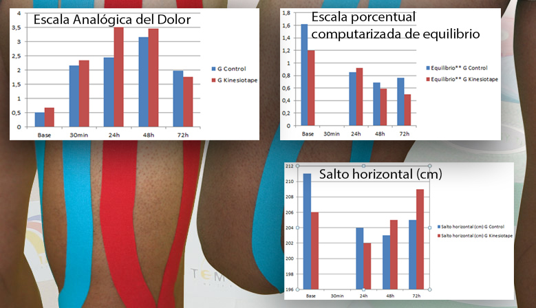 Aplicación del Kinesiotaping para la disminución de las agujetas