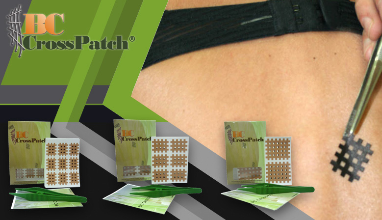 Cross Taping, técnica compatible con el Kinesiotaping - Efectiva en los puntos gatillo