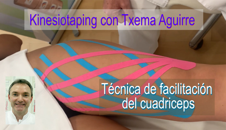 Técnica de Facilitación del Cuádriceps con Vendaje Neuromuscular Temtex