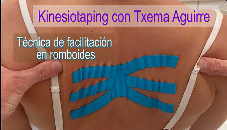 Video  Aplicacin de facilitacin de Kinesiotaping en el msculo romboides