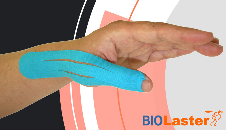 Tratamiento de la Rizoartrosis con Kinesiotaping