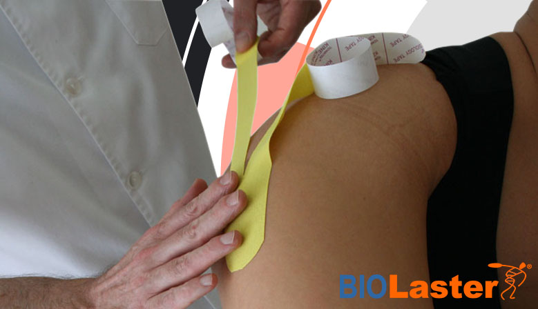Trocanteritis, aplicación de kinesiotaping con Temtex y FastU