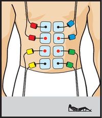 electroestimulacion COMPEX One entrenamiento musculatura rehabilitacion fuerza posicin electrodos marcar abdominales