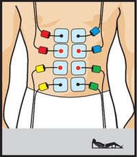 electroestimulacion COMPEX One entrenamiento musculatura rehabilitacion fuerza posicin electrodos marcar abdominales