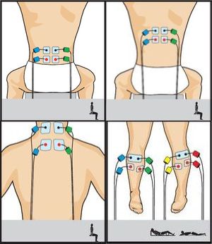 electroestimulacion COMPEX One entrenamiento musculatura rehabilitacion fuerza posicin electrodos marcar abdominales