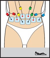 Electroestimulador Compex ONE - Electroestimuladores