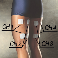 cefar electroestimulacion rehabilitacion prevencion rendimiento