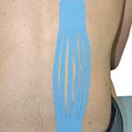 FastU - Herramienta de corte longitudinal para su uso en los tapes de Vendaje Neuromuscular - Kinesiotaping