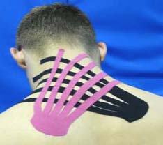 kinesiology tape vendaje neuromuscular