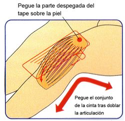 kinesiology tape supporter vendaje neuromuscular