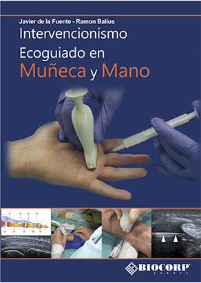 disponible a la venta del nuevo libro escrito por Javier de la Fuente y Ramon Balius. Intervencionismo ecoguiado en mano y mueca