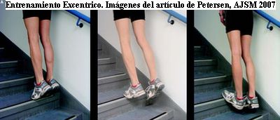 entrenamiento excentrico tendinitis aquiles fascitis plantar