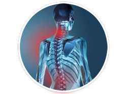 producto ortopedia estabilizacion columna vertebral correccion dinamico postural W-Wear cuello