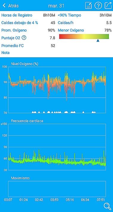 oximetria pulso pulsioximetro saturacion arterial oxigeno con el pulsioxmetro inteligente BCOXygen Oxysleep