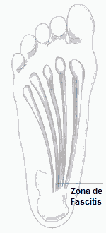 traumatologia pie lesiones arco plantar interno