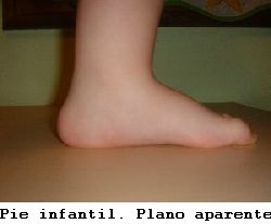 pie infantil