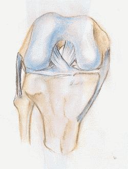 ligamento cruzado anterior rodilla