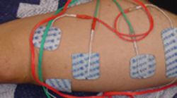 rodilla artroscopia ligamento cruzado anterior