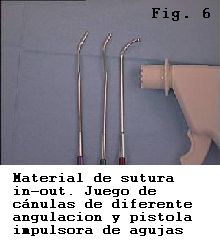 rodilla sutura menisco material