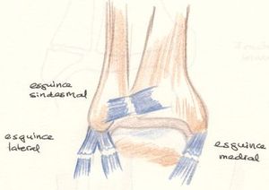 tipos esguince ligamentos tobillo