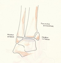 fractura maleolo tobillo tibia perone