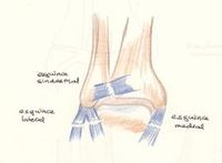 rotura ligamentos pie tobillo externo esguince