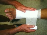tratamiento recuperacion vendaje ligamentos pie tobillo externo esguince
