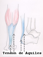 traumatologia pie lesiones tendinitis tendinosis tendinopatia Aquiles tratamiento terapias