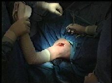 traumatologia cirugia ortopedica hombro