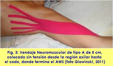kinesiology taping vendaje neuromuscular linfatico adherencia cicatrizal AWS