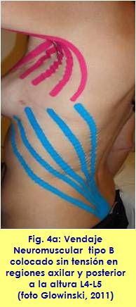 kinesiology taping vendaje neuromuscular linfatico adherencia cicatrizal AWS